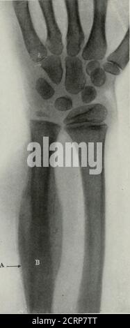 Child Rentgen . Living anatomy and pathology; . FIG. 1 Stock Photo - Alamy