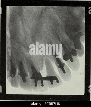 . Elementary and dental radiography . Fig- -M... Fig. 247. Fig. 246 ...