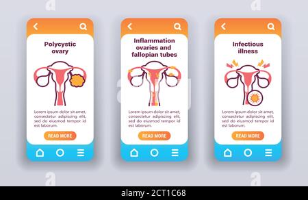 Female reproductive disease on mobile app onboarding screens. Stock Vector