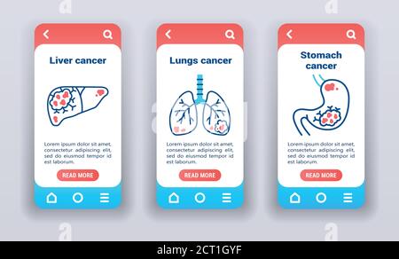 Malignant neoplasm, metastases on mobile app onboarding screens. UI UX GUI template. Stock Vector