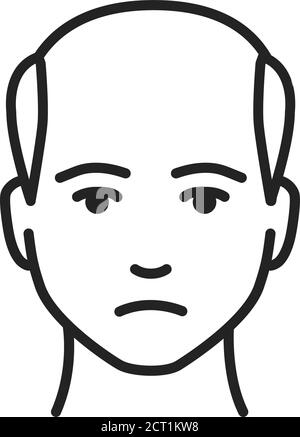 Man with a bald head black line icon. Baldness stage. Alopecia. Editable stroke. Stock Vector