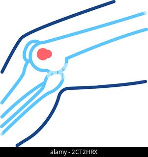 Osteogenic sarcoma is a cancerous tumor in a bone line color icon. Human anatomy concept. Malignant neoplasm. Sign for web page, mobile app, button Stock Vector