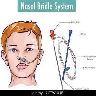 Bridle deals ng tube