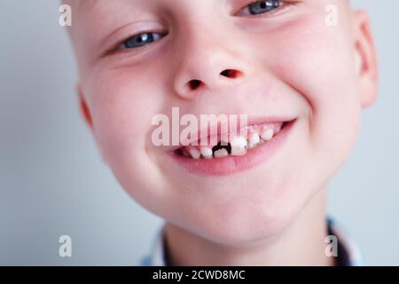 Baby smile without upper baby tooth. A hole in a child's smile. Cheerful concept.Health care, dental hygiene. Stock Photo