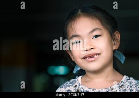 Asian child girl missing front tooth, smiling face. Close up to cute face, space for copy and design. Eyes looking at camera. Stock Photo