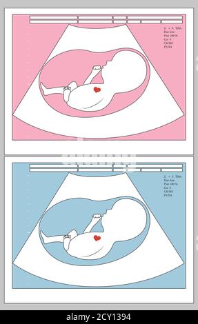 Ultrasound of unborn baby in mother's womb, boy or girl, medical concept, vector illustration. Stock Vector