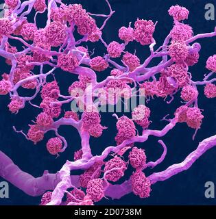 Kidney glomeruli. Coloured scanning electron micrograph (SEM) of a resin cast of glomeruli capillaries and the larger blood vessels supplying them wit Stock Photo