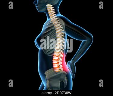 Lower back pain, illustration. Stock Photo