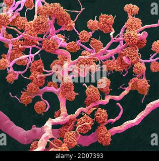 Kidney glomeruli. Coloured scanning electron micrograph (SEM) of a resin cast of glomeruli capillaries and the larger blood vessels supplying them wit Stock Photo