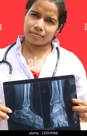 Young lady doctor with x ray wearing lab coat and smiling face with red isolated background. Stock Photo