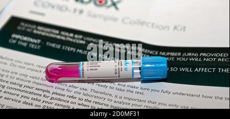 The Coronavirus home collection test kit contains a nasal and throat swab which collect a sample of cells which is sent back to a lab for testing. The lab performs a very sensitive test that looks for the RNA of the virus using a technique called RT-PCR. RT-PCR tests work by detecting specific genetic material known as viral RNA within the virus. By detecting viral RNA, which will be present in the body before symptoms of the disease are present, the tests can tell whether or not someone has the virus very early on. Stock Photo