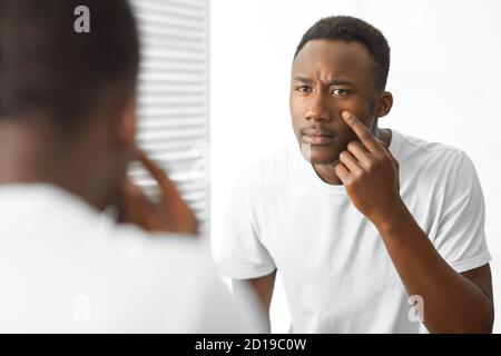 Worried Black Guy Touching Acne On Face Standing In Bathroom Stock Photo