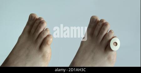 A corn plaster on the little toe of a foot, isolated on white background. Stock Photo