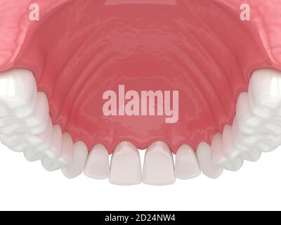 3d render of human upper jaw with black triangles between teeth Stock Photo