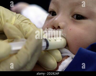 A baby boy, inflicted with a cleft lip, tries to drink his milk from a syringe after his surgery during 'Operation Restore Hope' at Diosdado Macapagal Memorial Medical Center in Caloocan City, Metro Manila April 12, 2010. Operation Restore Hope, a group of medical volunteers from Germany, New Zealand and Australia who perform surgeries for underprivileged children every year, aim to provide free surgery for about 70-80 children inflicted with cleft lips, cleft palates, and other facial deformities over a period of five days. REUTERS/Cheryl Ravelo (PHILIPPINES - Tags: HEALTH SOCIETY)