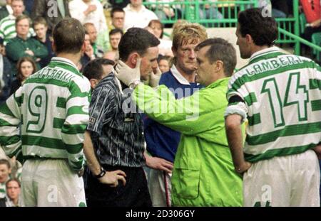 Referee Hugh Dallas receives medical attention after being injured during the Scottish Premier League match between Celtic and Rangers game at Parkhead. Dallas was struck on the forehead by the object, thought to be a coin, shortly after sending off a Celtic player. Stock Photo