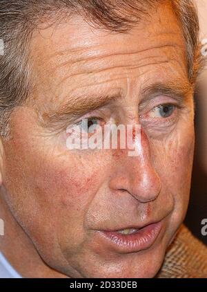 The Prince of Wales, during a visit to Skipton Auction Mart, the Prince was sporting an abrasion on the bridge of his nose which was the result of an argument with a hedge, officials said. Charles, was returning to the county to continue his campaign to encourage the revival of rural communities and later in the day was due to open a new agricultural, rural business, education and training centre. Stock Photo