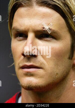 A plaster is visible over the left eyebrow of Manchester United mid-fielder David Beckham, during the team line-up before the UEFA Champions League group D match against Juventus at Old Trafford, Manchester. THIS PICTURE CAN ONLY BE USED WITHIN THE CONTEXT OF AN EDITORIAL FEATURE. NO WEBSITE/INTERNET USE UNLESS SITE IS REGISTERED WITH FOOTBALL ASSOCIATION PREMIER LEAGUE. NO PUBLICATION ON ANY INTERNET SITE DURING MATCH (INCLUDING HALF TIME, EXTRA TIME AND PENALTY SHOOT-OUTS).THIS PICTURE CAN ONLY BE USED WITHIN THE CONTEXT OF AN EDITORIAL FEATURE. NO WEBSITE/INTERNET USE UNLESS SITE IS REGISTE Stock Photo