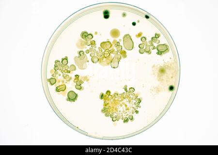Mixed of bacteria colonies and fungus in various petri dish Stock Photo
