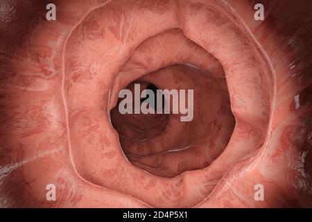 3D Illustration of a gastrointestinal polyp during Entersocopy Stock Photo