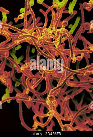 Ebola Virus From Mali Blood Sample Ebola virus isolated in November 2014 from patient blood samples obtained in Mali. The virus was isolated on Vero c Stock Photo