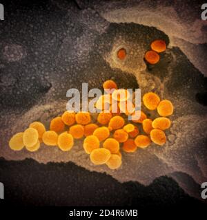 This scanning electron microscope image shows SARS-CoV-2 (orange)—also known as 2019-nCoV, the virus that causes COVID-19—isolated from a patient in t Stock Photo