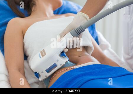 CoolSculpting ®, Cryolipolysis session, noninvasive method of permanent reduction of localized fat, France. Stock Photo