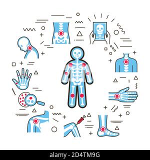 Arthritis human body web banner. Infographics with linear icons on white background. Creative idea concept. Isolated outline color illustration. Stock Vector