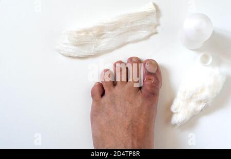 A close-up photo of a broken big toe with several cuts and bruises. The first medical aid. Top view. Isolated on white background. Stock Photo