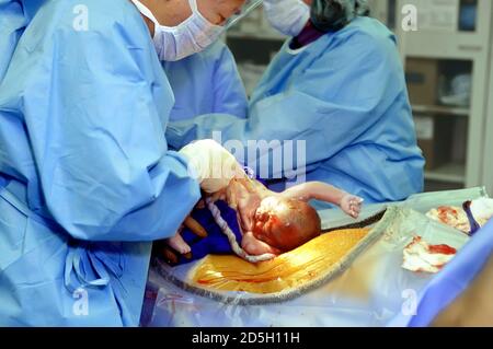 Doctors in an operating room perform a Caesarean Birth on a pregnant female Stock Photo