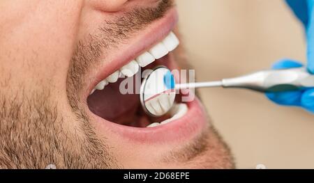 Healthy white male smile with dentist's mirror, close-up. Teeth treatment. Shot part of the head Stock Photo