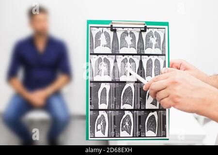 Pulmonologist showing CT scan of lungs patient with pulmonary fibrosis, after recovery, lung disease Stock Photo