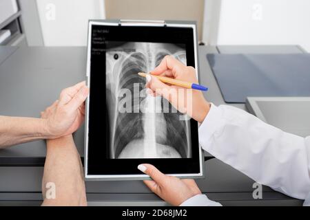 Pulmonologist showing an old patient an X-ray image of her lungs. Prevention and treatment of lung disease, pneumonia, coronavirus Stock Photo