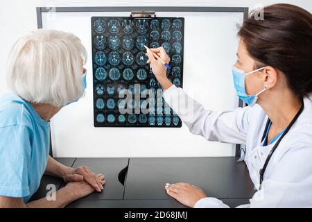 doctor explains to an elderly woman the results of an MRI scan of her brain. Diagnosis of diseases and head injuries Stock Photo