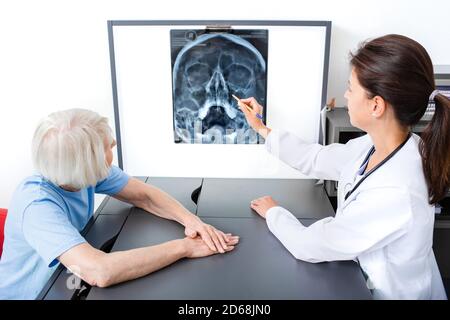 doctor consider and discuss with senior patient X-ray of her head and maxillary sinuses. Diagnostics and treatment of sinusitis and frontal sinusitis Stock Photo