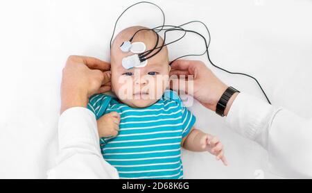 Newborn hearing screening and diagnosis at the hospital. Baby having hearing screening with special electrodes on his head and ear Stock Photo