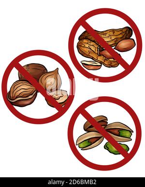 Set of cartoon nuts in the prohibition sign. Free from nuts. Ban on allergens. Allergy Alert. Badges with forbiddance. Vector element for recipes, men Stock Vector