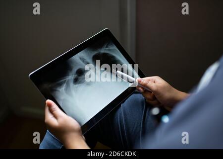 Hands holding digital tablet showing X-ray Stock Photo