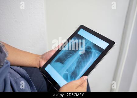 Hands holding digital tablet showing X-ray Stock Photo