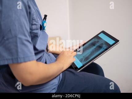 Hands holding digital tablet showing X-ray Stock Photo