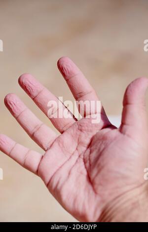 wrinkled skin from water