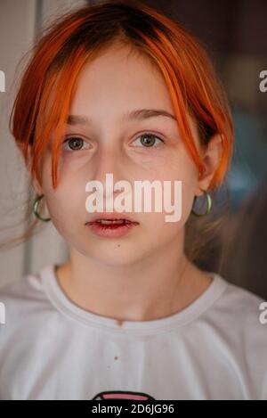 little girl with a broken lip. Girl with a broken lip Stock Photo