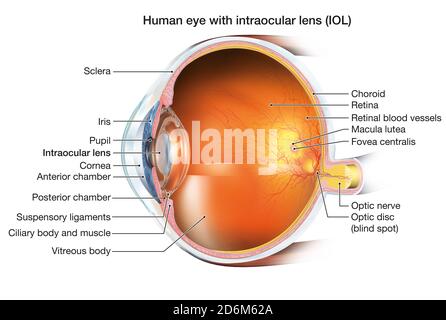 Medically 3D illustration showing human eye with intraocular lens (IOL), retina, pupil, iris, anterior chamber, posterior chamber, ciliary body, eye b Stock Photo