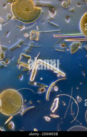 Strewn diatoms including Eupodiscus ralfsii Stock Photo