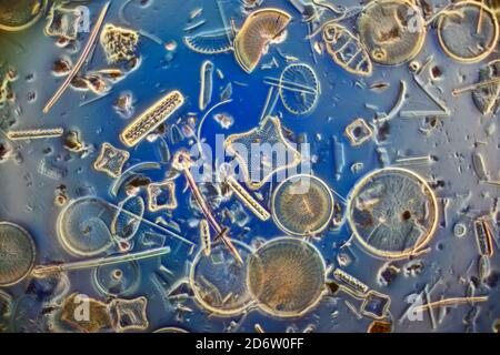 Strewn diatoms including Eupodiscus ralfsii Stock Photo