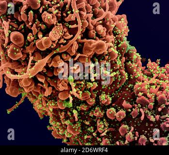 Colorized scanning electron micrograph of a cell showing morphological signs of apoptosis, infected with SARS-COV-2 virus particles (green), isolated Stock Photo