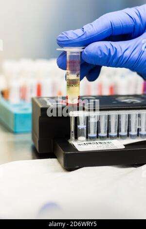 Processing of BioFire ® FilmArray tests. This test provides reliable results for the identification of 23 targets (viruses and bacteria) responsible f Stock Photo