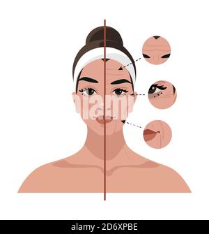 Portrait of a young woman and age-related changes on her face. Before and after cosmetic procedures, injections, plastic surgery. Flat vector illustration Stock Vector