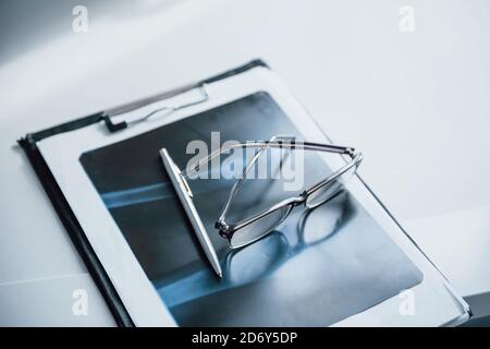 Notepad, x-ray paper, pen and glasses lying on the white table Stock Photo