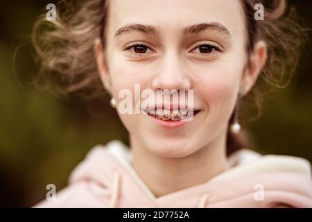 Close-up portrait of a teenage girl in braces. Stock Photo